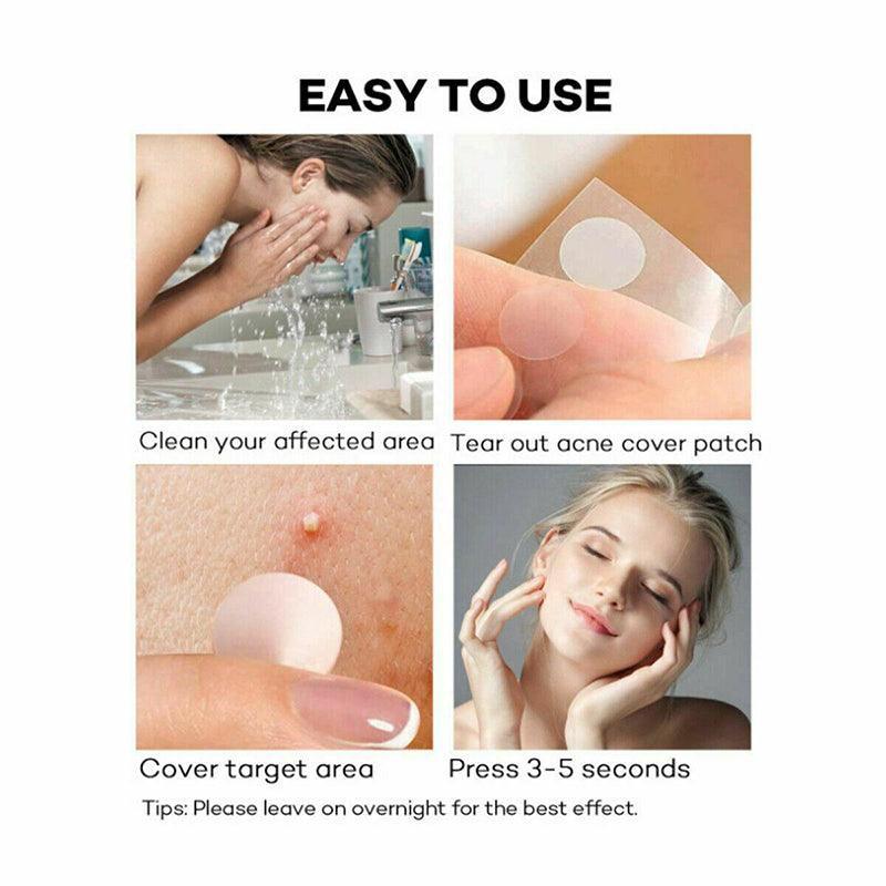 36 Pcs Acne Pimple Plasters Patch Removal Blemish Control Skin Facial Care Spot