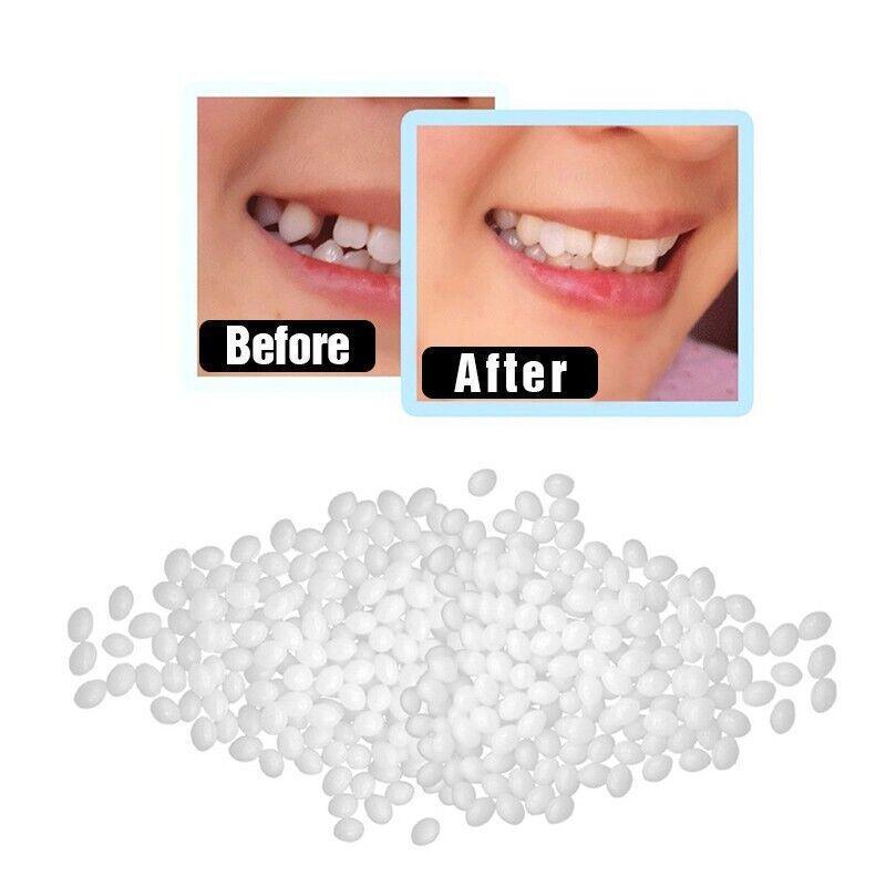 Temporary Tooth Repair Kit Teeth Gaps False Teeth Solid Glue Denture Adhesive - 10G
