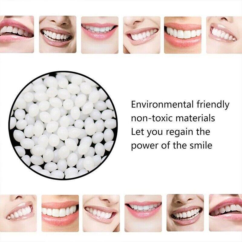 Temporary Tooth Repair Kit Teeth Gaps False Teeth Solid Glue Denture Adhesive - 10G