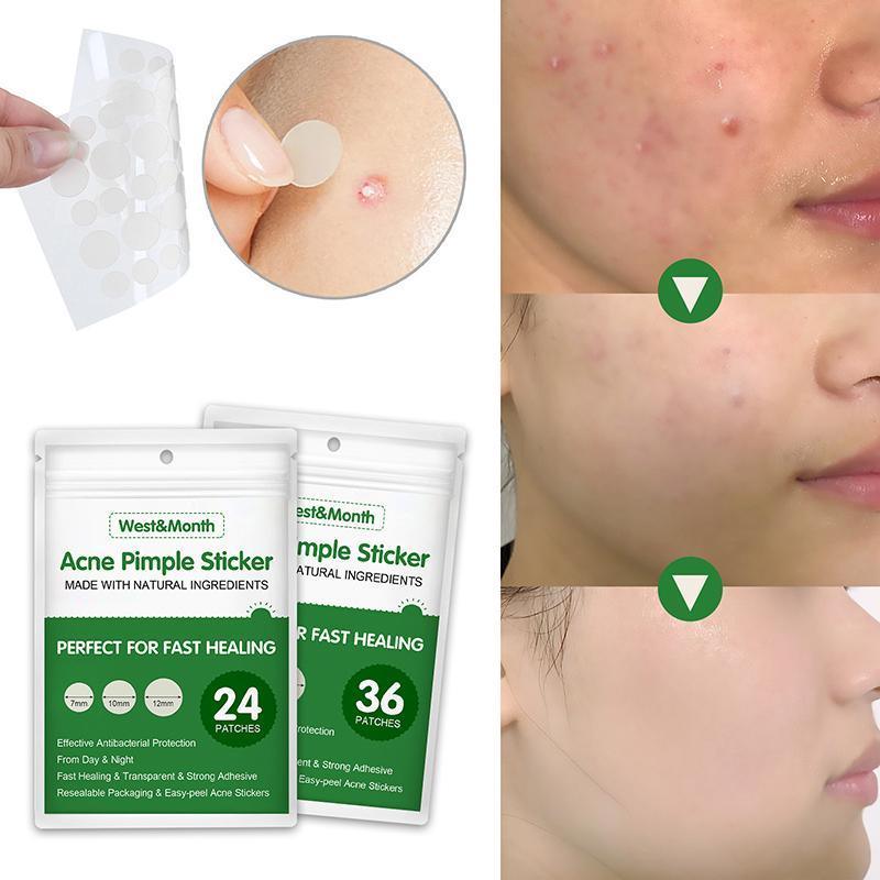Skin Tag Remover Acne Pimple Patch Removal Facial Care Spot Plaster - 24 PCS